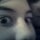 Brokennose