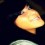 Hemmyxo