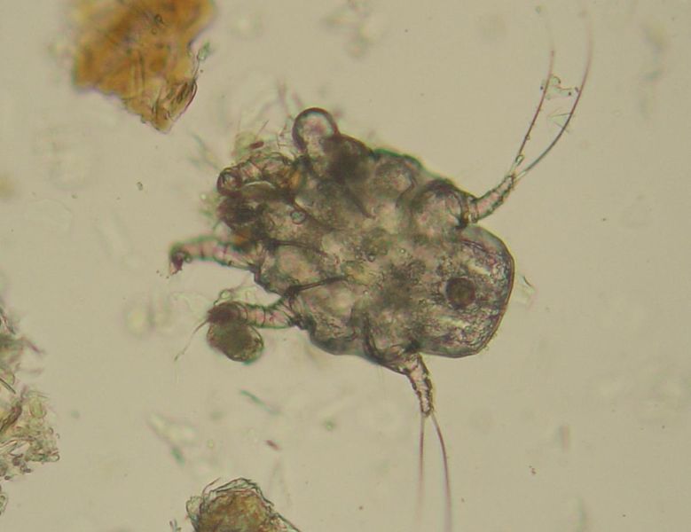 These mites are contagious and